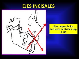 EJES INCISALES
Ejes largos de los
incisivos centrales sup
e inf.
 