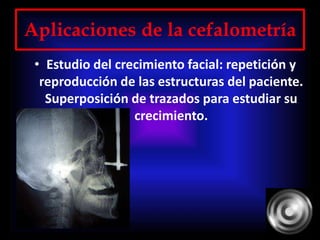 Aplicaciones de la cefalometría
• Estudio del crecimiento facial: repetición y
reproducción de las estructuras del paciente.
Superposición de trazados para estudiar su
crecimiento.
 