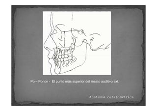 Po – Porion - El punto más superior del meato auditivo ext.



                                       Anatomía cefalométri...