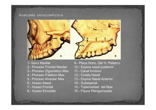Anatomía cefalométrica




    1- Seno Maxilar               9.- Placa Horiz. Del H. Palatino
    2.- Proceso Frontal Maxi...