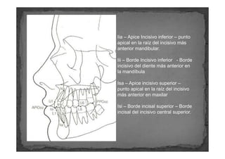 Iia – Apice Incisivo inferior – punto
apical en la raíz del incisivo más
anterior mandibular.

Iii – Borde Incisivo inferi...