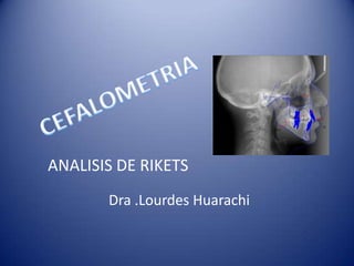 Dra .Lourdes Huarachi
ANALISIS DE RIKETS
 