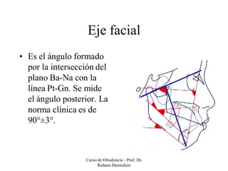 Cefalometria de Rickets - Análisis básico | PDF