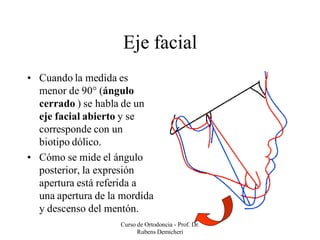 Cefalometria de Rickets - Análisis básico | PDF