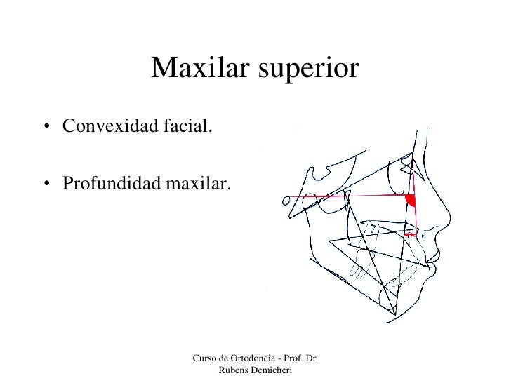 Cefalometria de Rickets - Análisis básico
