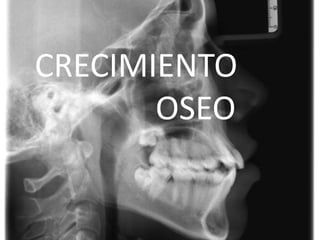CRECIMIENTO
OSEO

 