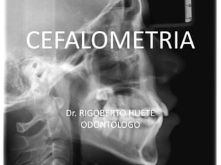 CEFALOMETRIA    Dr. Huete