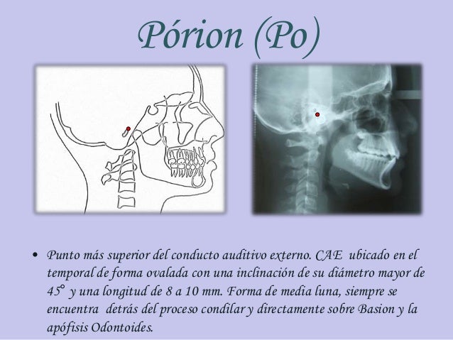 Cefalometria puntos y planos