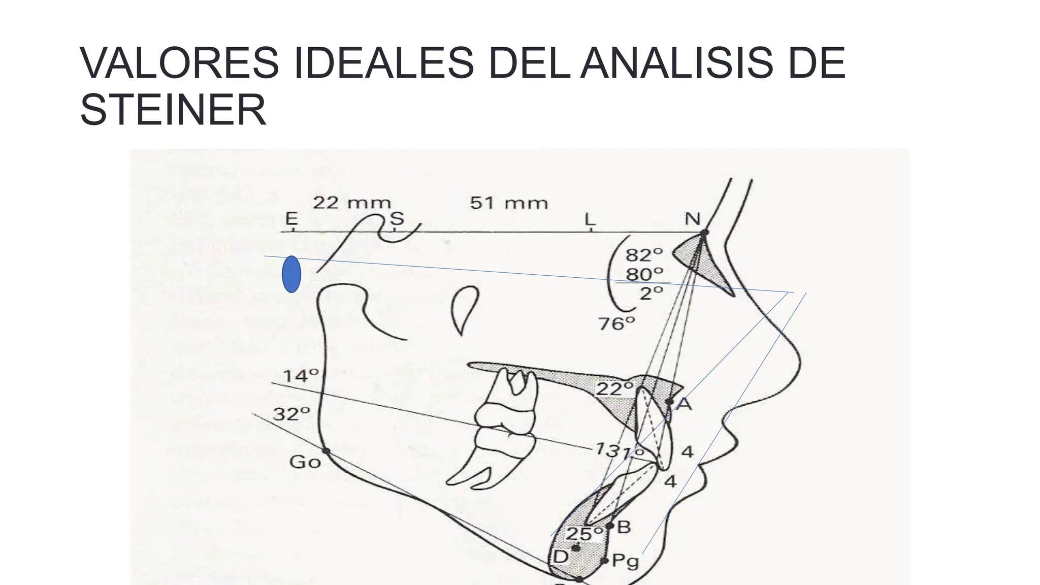 Análisis Cefalométrico de Steiner, JC, Morelia | PPTX