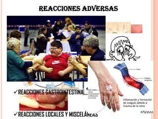 REACCIONES ADVERSAS
REACCIONES DE HIPERSENSIBILIDAD
REACCIONES HEMATOLÓGICAS
TOXICIDAD RENAL
REACCIONES GASTROINTESTINALES
REACCIONES LOCALES Y MISCELÁNEAS
 