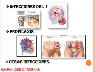 Infecciones del SNC
Otras infecciones.
Profilaxis
•MARÍA JOSÉ CÁRDENAS
 