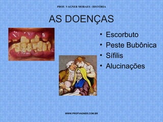PROF. VAGNER MORAES - HISTÓRIA 
AS DOENÇAS 
WWW.PROFVAGNER.COM.BR 
• Escorbuto 
• Peste Bubônica 
• Sífilis 
• Alucinações 
 