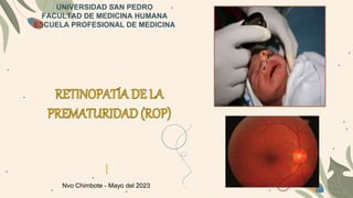 Nvo Chimbote - Mayo del 2023
UNIVERSIDAD SAN PEDRO
FACULTAD DE MEDICINA HUMANA
ESCUELA PROFESIONAL DE MEDICINA
 