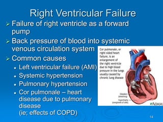 14
Right Ventricular Failure
 Failure of right ventricle as a forward
pump
 Back pressure of blood into systemic
venous circulation system
 Common causes
 Left ventricular failure (AMI)
 Systemic hypertension
 Pulmonary hypertension
 Cor pulmonale – heart
disease due to pulmonary
disease
(ie; effects of COPD)
 