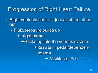 15
Progression of Right Heart Failure
 Right ventricle cannot eject all of the blood
out
 Fluid/pressure builds up
• In right atrium
Backs up into the venous system
Results in pedal/dependent
edema
 Visible as JVD
 