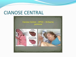 CIANOSE CENTRAL
 