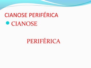 CIANOSE PERIFÉRICA
CIANOSE
PERIFÉRICA
 