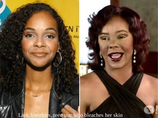 Trina Mcgee Bleached Skin