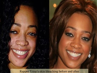 Trina Mcgee Bleached Skin