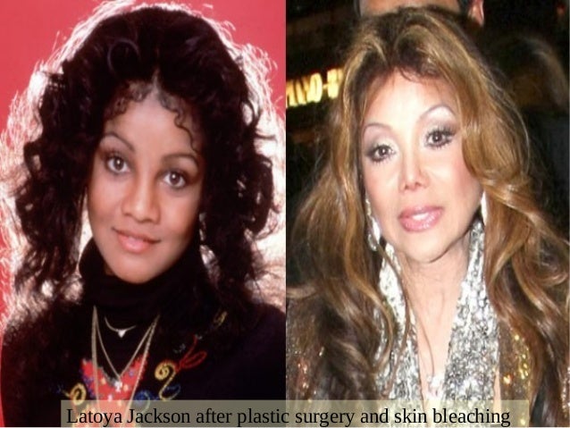 celebrity skin whitening celebrity bleach driverlayer search engine celebrity skin whitening celebrity bleach driverlayer search engine