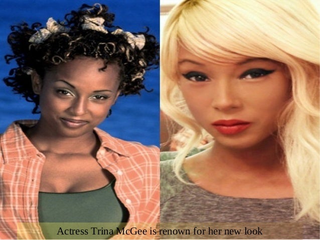 celebrity skin whitening celebrity skin whitening celebrity skin whitening celebrity skin whitening