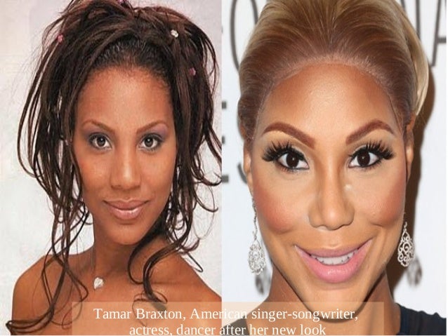 celebrity skin whitening celebrity skin whitening celebrity skin whitening celebrity skin whitening