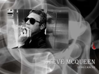 Steve McQueen
Lung cancer
 