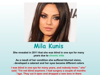 Mila Kunis
She revealed in 2011 that she was blind in one eye for many
years due to chronic iritis.
As a result of her condition she suffered blurred vision,
developed a cataract and her eyes became different colors.
"I was blind in one eye for many years, and nobody knew," she
said. "I'm not blind anymore. I had surgery a couple of months
ago. They cut it open and dropped a new lens in there."
 