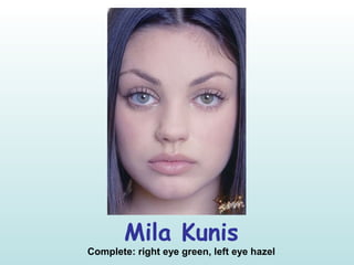 Mila Kunis
Complete: right eye green, left eye hazel
 