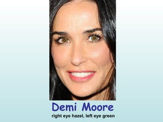 Demi Moore
right eye hazel, left eye green
 