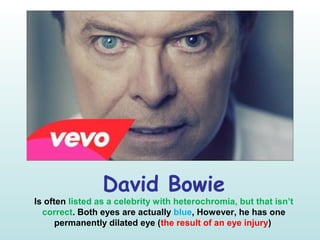 David Bowie
Is often listed as a celebrity with heterochromia, but that isn’t
correct. Both eyes are actually blue, However, he has one
permanently dilated eye (the result of an eye injury)
 