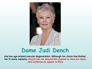 Dame Judi Dench
she has age-related macular degeneration. Although her vision has limited
her in some capacity, Dench has not allowed the disease to slow her down
and continues to appear in films.
 