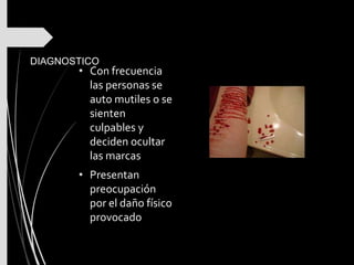 DIAGNOSTICO
• Con frecuencia
las personas se
auto mutiles o se
sienten
culpables y
deciden ocultar
las marcas
• Presentan
preocupación
por el daño físico
provocado
 