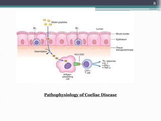 celiac disease 0r gluten enteropathy ppty | PPT