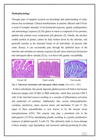3
Pathophysiology
Through years of targeted research our knowledge and understanding of celiac
disease has accelerated. Clinical manifestations in patients affected with CD are
a result of complex interplay of environmental exposure, genetic predisposition,
and immunologic response [5].The gluten in wheat is composed of two proteins,
gliadins (the primary toxic component) and glutenins [5]. Gliadin, the alcohol-
soluble portion of gluten, cannot be fully broken down by the intestine, and
generally remains in the intestinal lumen of all individuals. In persons with
celiac disease, it can occasionally pass through the epithelial layer of the
intestine and stimulate an immune response [6] and cause enterocyte destruction
and subsequentvillous atrophy [5] (Fig. 1) in those with genetic susceptibility.
Normal villi Partial atrophy Total atrophy
Fig. 1: Enterocyte destruction and subsequent villous atrophy (Horvath K., 2002)
In these individuals, this poorly digested gliadin protein will bind to the human
leukocyte antigen class II DQ2 or DQ8 molecules, which then activates CD4 T
cells in the intestinal mucosa resulting in a cascade of inflammatory activation
and production of cytokines. Additionally, they secrete immunoglobulins,
cytokines, interferons, tumor necrosis factor, and interleukin 15 and 17. The
target of these autoantibodies is now known to be the enzyme tissue
transglutaminase (tTG). This enzyme may play a prominent role in the
pathogenesis of CD by deamidating gliadin, resulting in a greater proliferative
response of gliadin-specific T-cells [7]. This ultimately leads to tissue damage
(villous atrophy, crypt hyperplasia, and increased antibody-producing B cells).
 