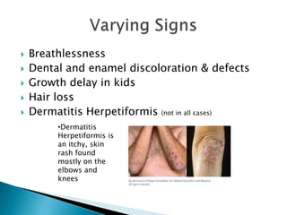 BreathlessnessDental and enamel discoloration & defectsGrowth delay in kidsHair lossDermatitis Herpetiformis (not in all cases)Varying SignsDermatitis Herpetiformis is an itchy, skin rash found mostly on the elbows and kneesAnother Form of CeliacDermatitis HerpetaformisSevere, itchy, blistering skin condition“Sister” to CeliacEveryone with DH has Celiac, but not everyone with Celiac has DH!!!Found on elbows, knees, buttock, scalp, back of neckBlistering Dermatitis Herpetaformis