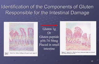 Identification of the Components of Gluten
  Responsible for the Intestinal Damage


                    Gluten 1g
                       Or
                 Gluten peptide
                  p56-74 50mg
                 Placed in small
                    intestine


                                        45
 