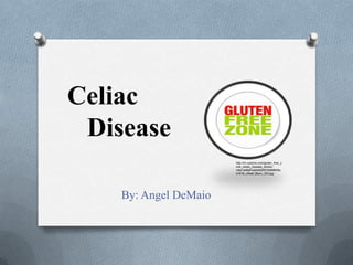 Celiac
Disease
By: Angel DeMaio
http://rlv.zcache.com/gluten_free_z
one_celiac_disease_sticker-
rdbe1a4fa61ad4d029533569645a
a1816_v9waf_8byvr_324.jpg
 
