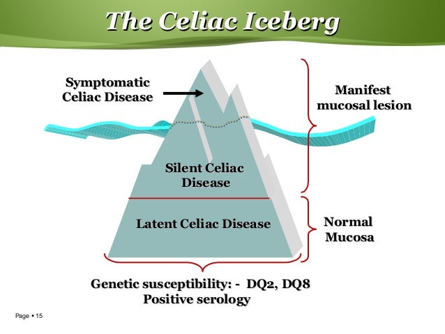celiac-disease