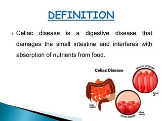  Celiac disease is a digestive disease that
damages the small intestine and interferes with
absorption of nutrients from food.
 