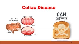 Celiac Disease
1
 