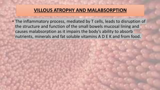 VILLOUS ATROPHY AND MALABSORPTION
• The inflammatory process, mediated by T cells, leads to disruption of
the structure and function of the small bowels mucosal lining and
causes malabsorption as it impairs the body’s ability to absorb
nutrients, minerals and fat soluble vitamins A D E K and from food.
 
