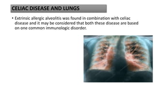 CELIAC DISEASE AND LUNGS
• Extrinsic allergic alveolitis was found in combination with celiac
disease and it may be considered that both these disease are based
on one common immunologic disorder.
 