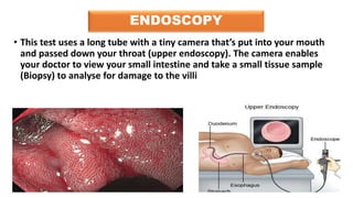 ENDOSCOPY
• This test uses a long tube with a tiny camera that’s put into your mouth
and passed down your throat (upper endoscopy). The camera enables
your doctor to view your small intestine and take a small tissue sample
(Biopsy) to analyse for damage to the villi
 