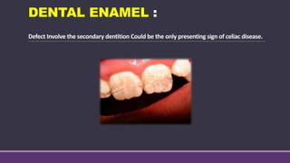 DENTAL ENAMEL :
Defect Involve the secondary dentition Could be the only presenting sign of celiac disease.
 