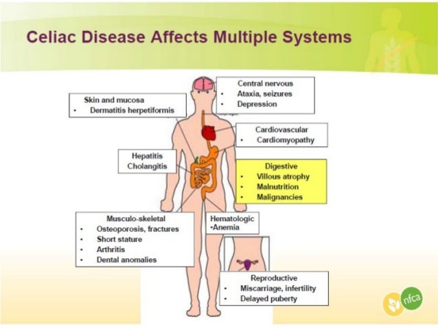 Distended Stomach – Symptoms, Causes and Treatment