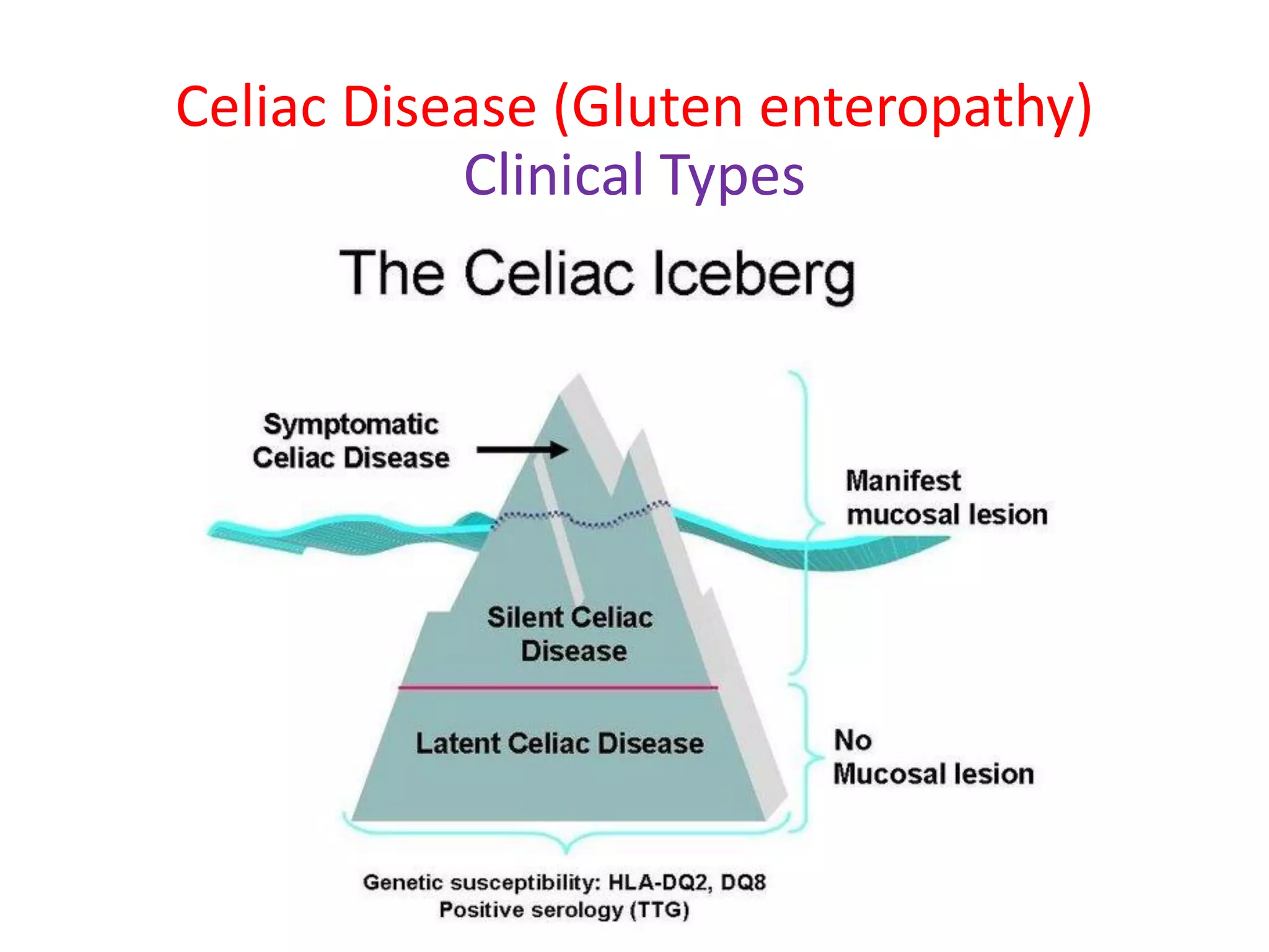 Celiac Disease (Gluten enteropathy)
Clinical Types
 