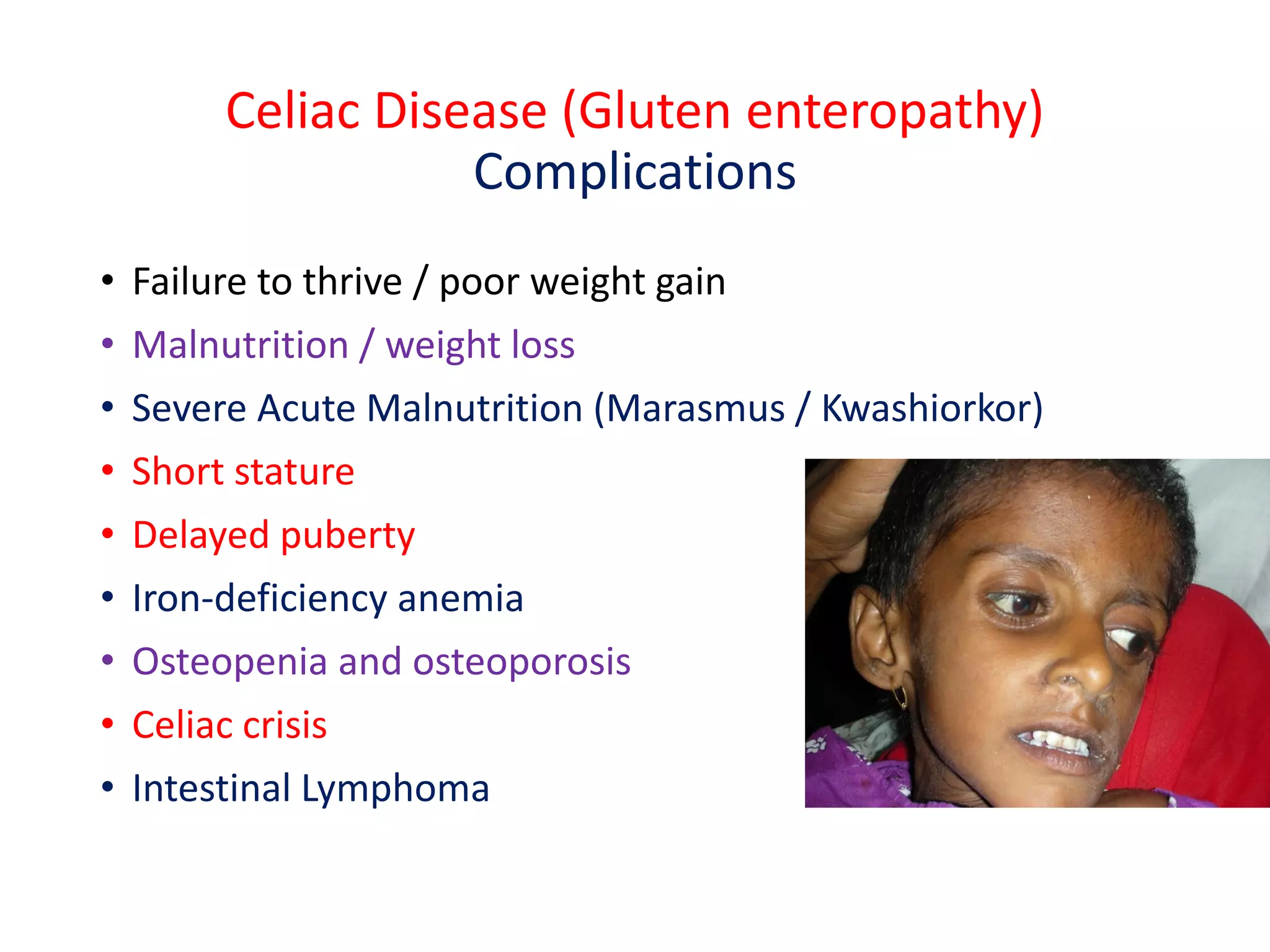 Celiac Disease (Gluten enteropathy)
Complications
• Failure to thrive / poor weight gain
• Malnutrition / weight loss
• Severe Acute Malnutrition (Marasmus / Kwashiorkor)
• Short stature
• Delayed puberty
• Iron-deficiency anemia
• Osteopenia and osteoporosis
• Celiac crisis
• Intestinal Lymphoma
 
