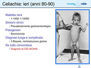 Celiachia: ieri (anni 80-90)‏ Malattia rara 1:1000/ 1:10000 Sintomi clinici Prevalentemente gastroenterologici Patogenesi Sconosciuta Diagnosi lunga e complicata 3 Biopsie, reintroduzione glutine Se tutto concordava Diagnosi di CELIACHIA 