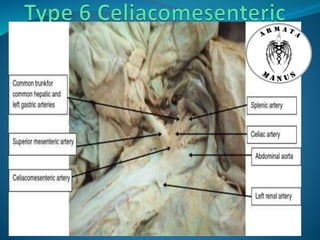 Celiac trunk anatomy